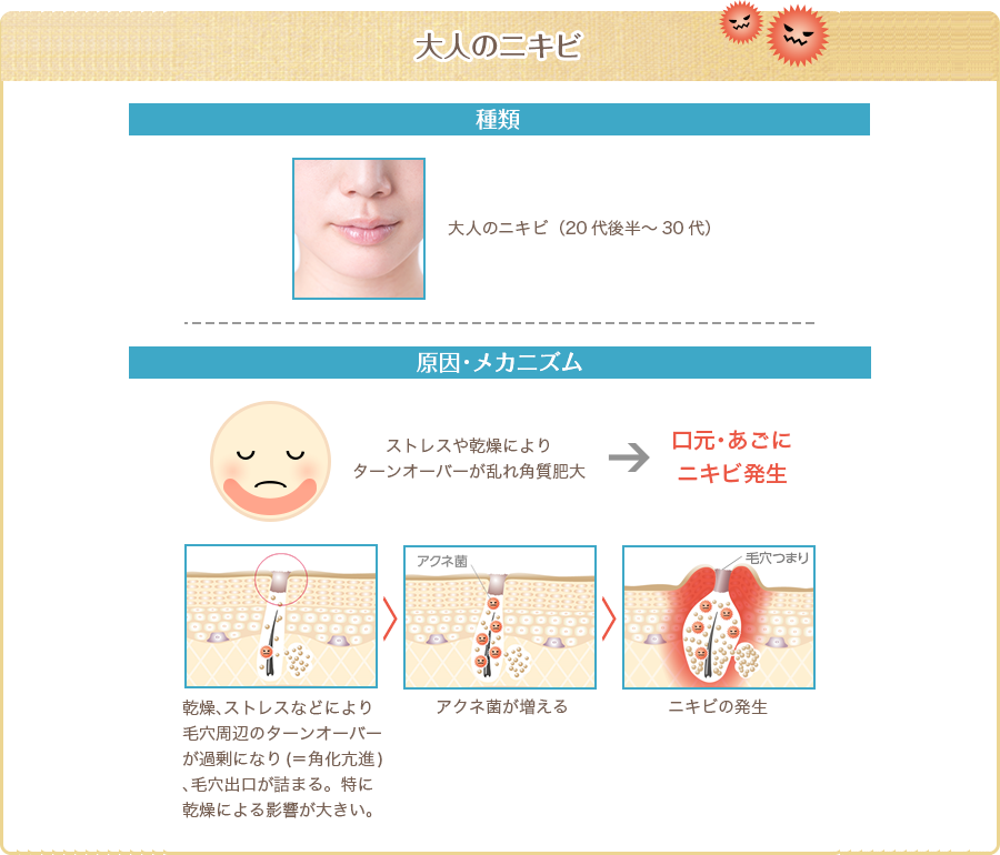 大人のニキビ
