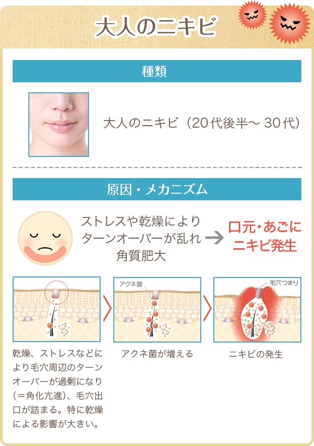 大人のニキビ