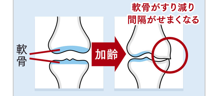 軟骨 →加齢 軟骨がすり減り間隔がせまくなる