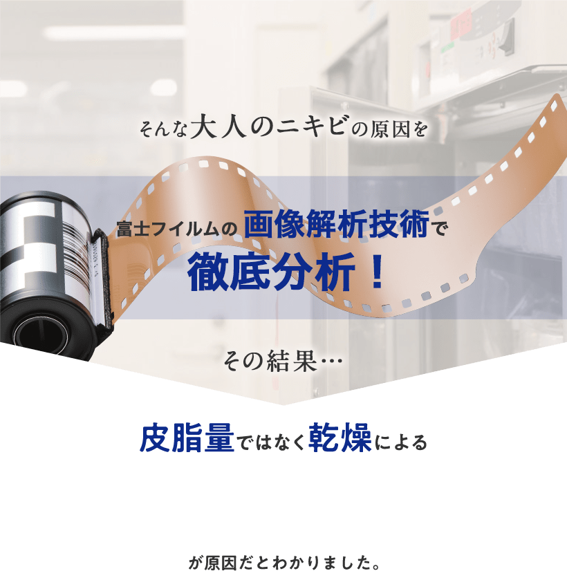 そんな大人のニキビの原因を富士フイルムの画像解析技術で徹底分析！その結果…皮脂量ではなく乾燥による…が原因だとわかりました。