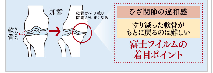ひざ関節の違和感 すり減った軟骨がもとに戻るのは難しい 富士フイルムの着目ポイント 加齢 軟骨がすり減り間隔がせまくなる