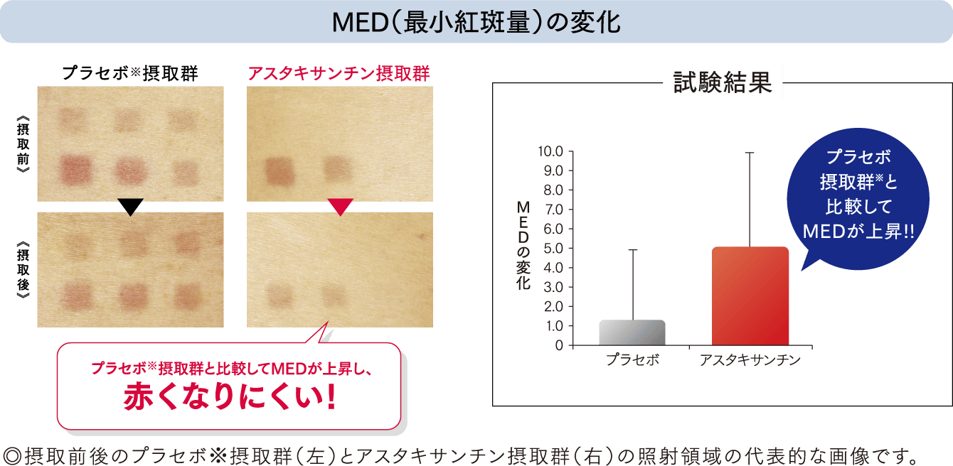 MED（最小紅斑量）の変化