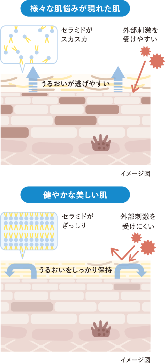 様々な肌悩みが現れた肌 セラミドがスカスカのため外部刺激を受けやすく、うるおいが逃げやすい イメージ図　健やかな美しい肌 セラミドがぎっしりで外部刺激を受けにくく、潤いをしっかり保持　イメージ図