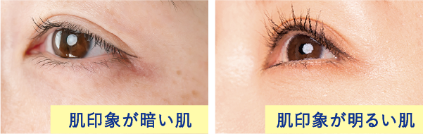 肌印象が暗い肌 肌印象が明るい肌
