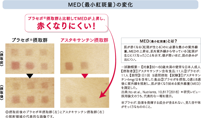 MED（最小紅斑量）の変化