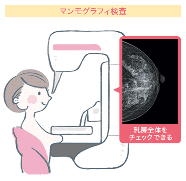 マンモグラフィ検査