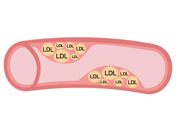 女性は年齢とともにコレステロールに要注意 ビューティー ヘルスケア特集 Fujifilm ビューティー ヘルスケア Online
