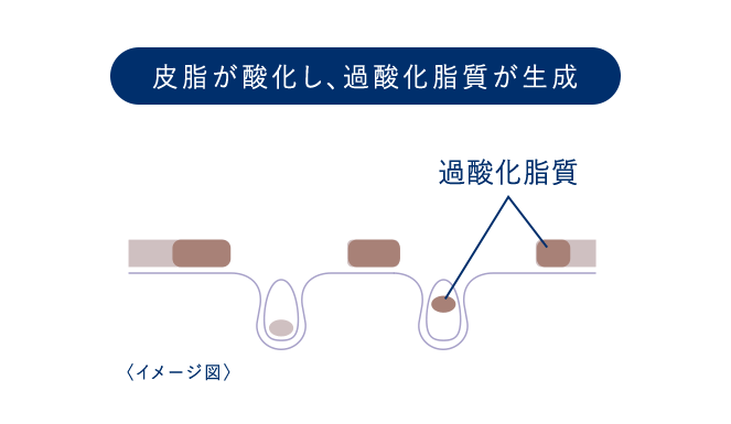 過酸化脂質について