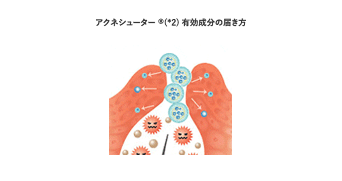 アクネシューター 有効成分の届き方