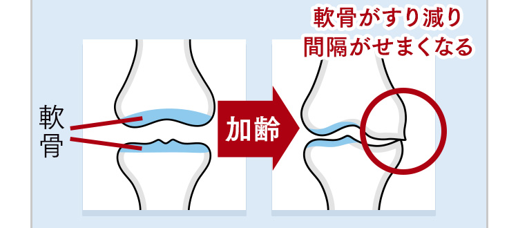 軟骨 →加齢 軟骨がすり減り間隔がせまくなる