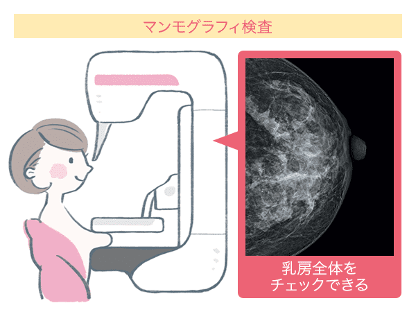 マンモグラフィ検査