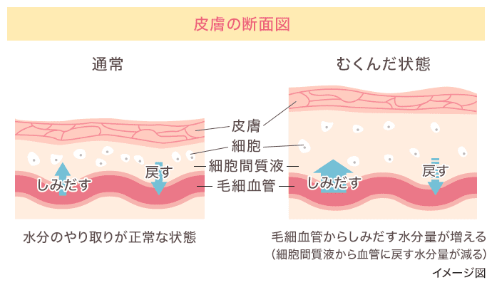 皮膚の断面図