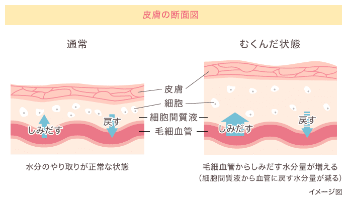 皮膚の断面図