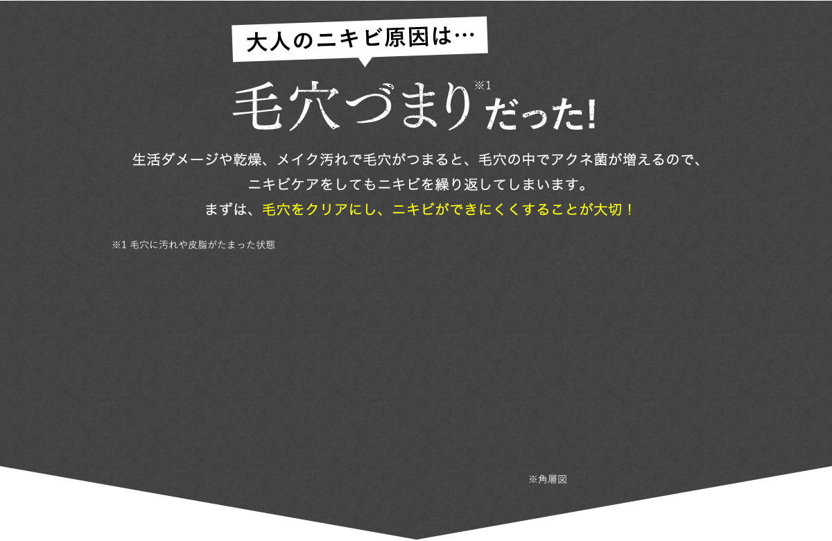 大人のニキビ原因は…毛穴づまりだった！